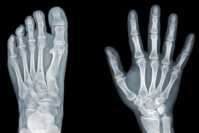 North Canterbury Xray