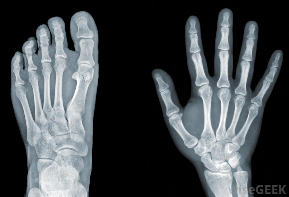 foot and hand xray